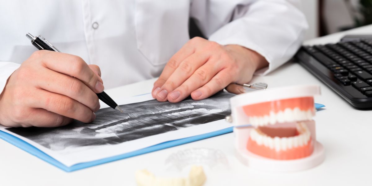 The Step-by-Step Process of Getting Dental Implants in Irvine